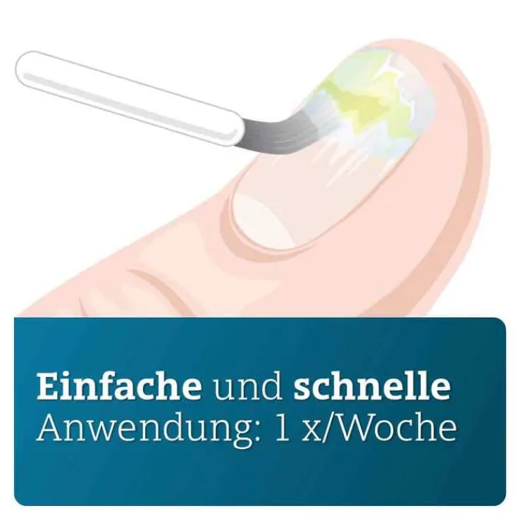 Amorolfin ADGC 50 mg / ml wirkstoffhalt.Nagellack, 5 ml