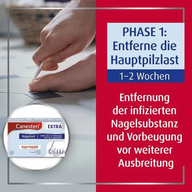 Canesten EXTRA Nagelset zur Behandlung von Nagelpilz, 1 St