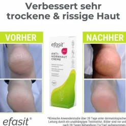 Efasit Anti-Hornhaut Creme, 75 ml