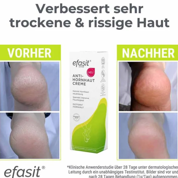 Efasit Anti-Hornhaut Creme, 75 ml