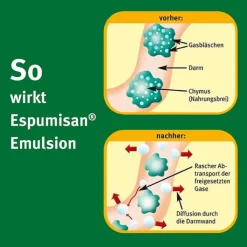 Espumisan Emulsion, 3X32 ml