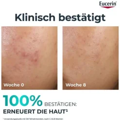 Eucerin Dermopure Clinical Peeling 10 Nachtcreme, 40 ml