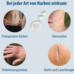 Evolsin Narben Gel, 20 g
