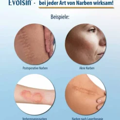 Evolsin Narbenpflaster 2,5cm x 200cm, 1 St