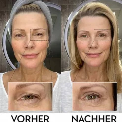 Lidperfect Augengel bei Schlupflidern, 15 ml