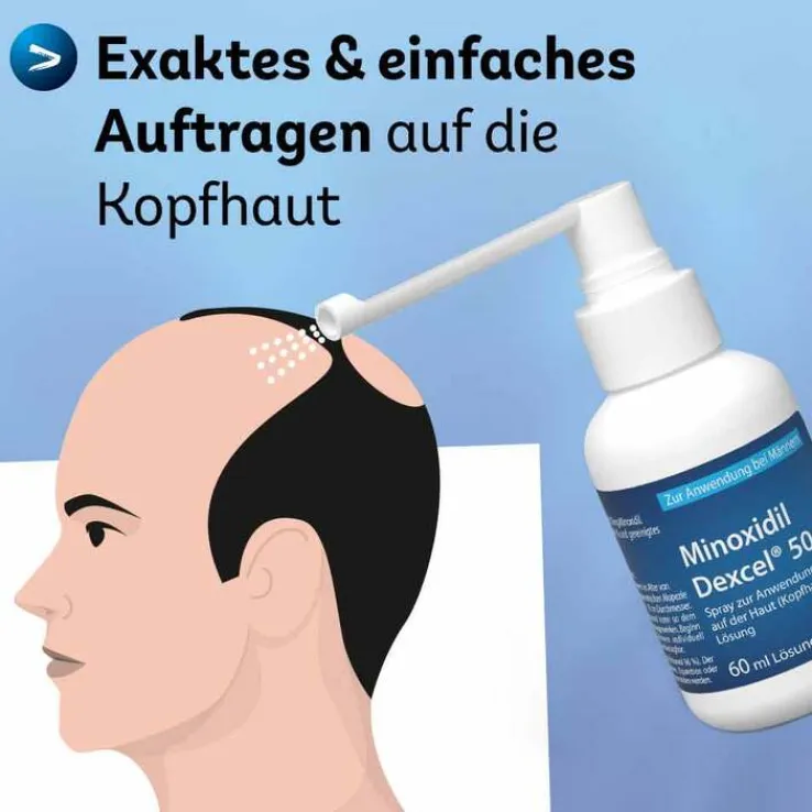 Minoxidil Dexcel 50 mg / ml Spray z.Anw.a.d.Kopfhaut, 60 ml