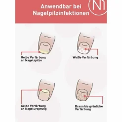 N1 Nagelpilz Lösung, 10 ml