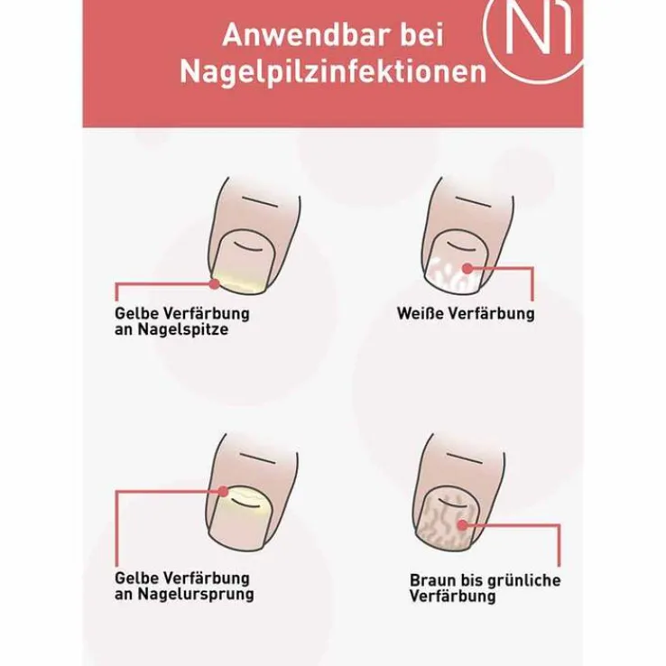 N1 Nagelpilz Lösung, 10 ml