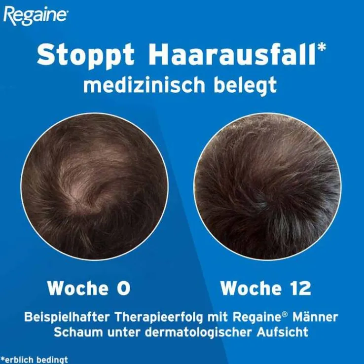 Regaine Männer Lösung, 60 ml