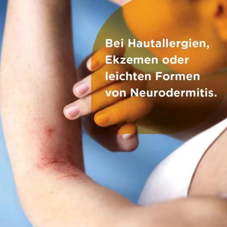 Soventol® HydroCort 0,5% Creme bei akuten Hautentzündungen, 15 g