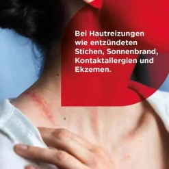 Soventol® HydroCortisonacetat 0,5% Cremogel bei Hautentzündungen, 30 g