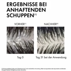 Vichy Dercos Anti-Schuppen Shampoo trockene Kopfhaut, 200 ml